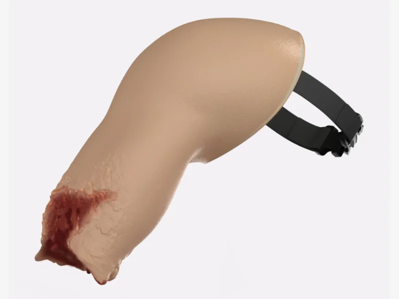Wearable Upper Limb Amputation Overlay – Type A