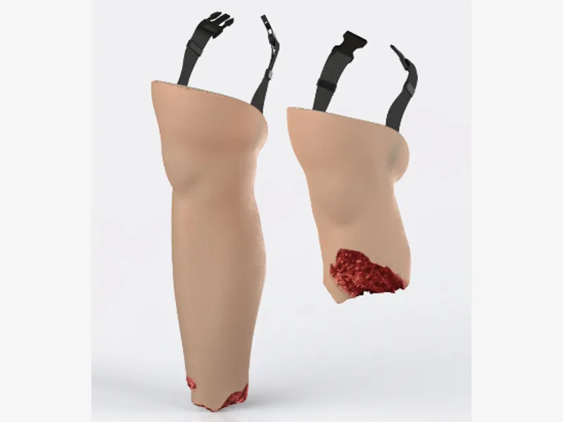 Wearable Lower Limb Amputation Overlay – Type A